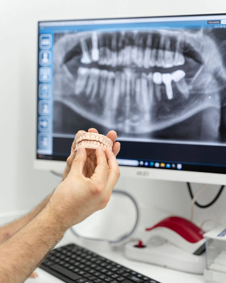 Prótesis Dental