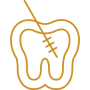 icono-endodoncia Endodoncia